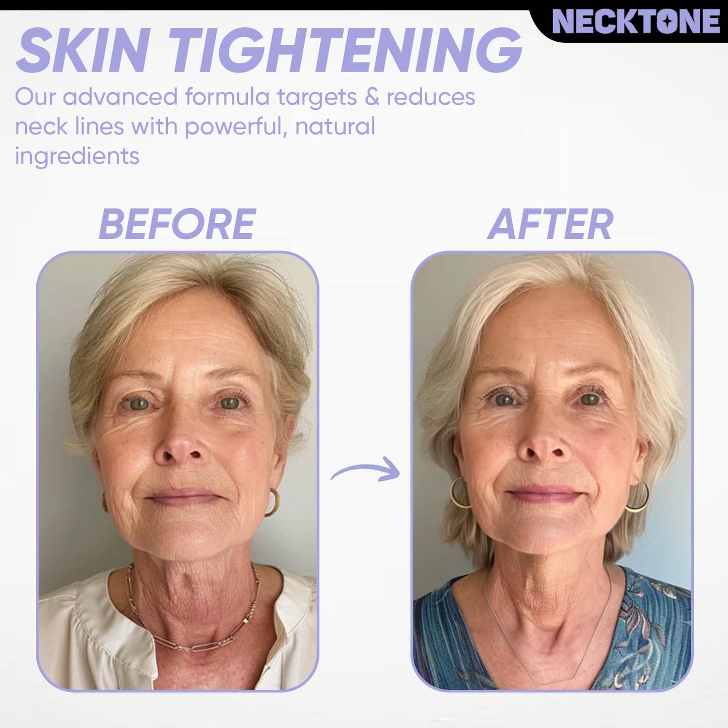 NeckTone Tightening Cream